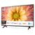 LG UN7070 75" (75UN70706LD)