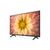 LG UN7070 75" (75UN70706LD)