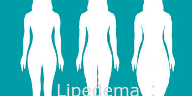 Lipedema: cos'è e guida ai migliori rimedi per contrastarla