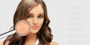 Pori dilatati: guida alla skincare step by step