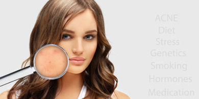 Pori dilatati: guida alla skincare step by step