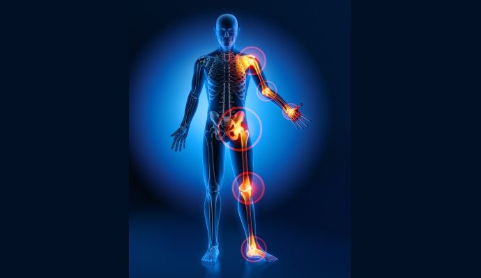 Come rafforzare la cartilagine con gli integratori giusti