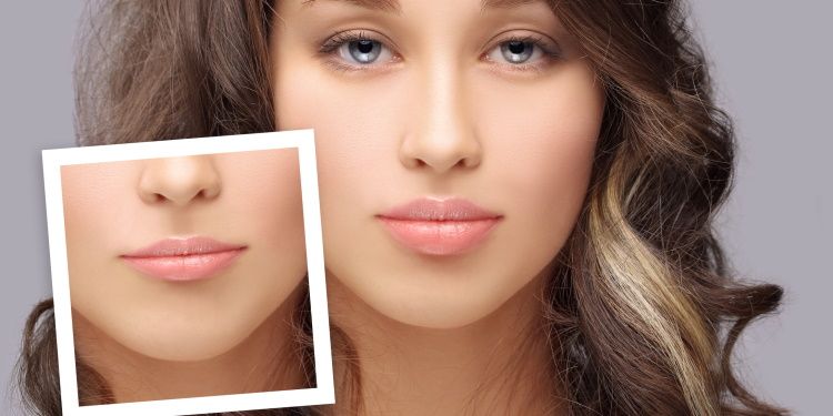 Filler per labbra