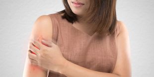 Dermatite: cos’è, tutti i sintomi e come affrontarla