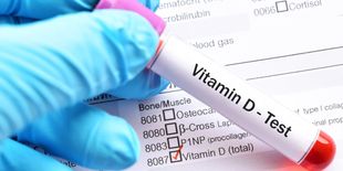 Vitamina D bassa: come riconoscere i sintomi e cosa fare