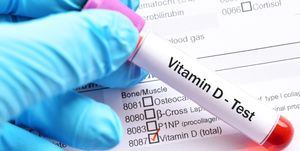 Vitamina D bassa sintomi: cosa fare