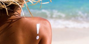 Eritema solare: cos’è, come prevenirlo e tutti i rimedi