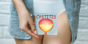 Cistite: guida all’acquisto dei migliori prodotti per prevenirla e combatterla